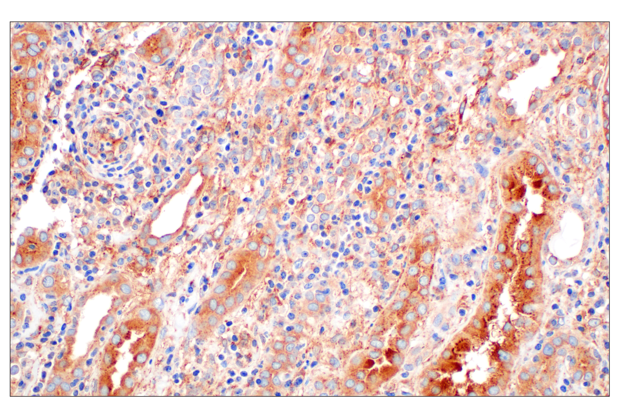 Immunohistochemistry Image 4: EEA1 (E9Q6G) Mouse mAb