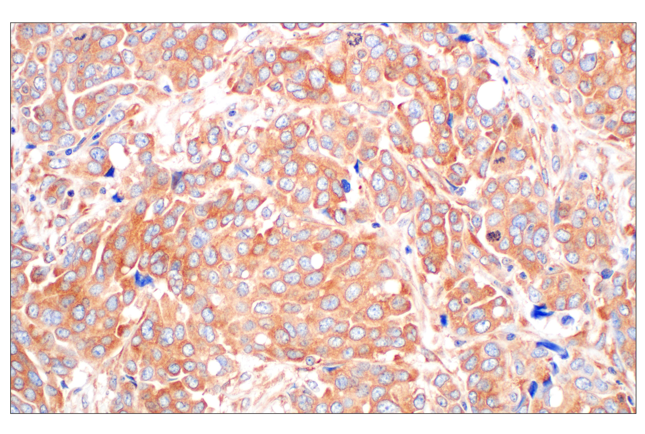 Immunohistochemistry Image 2: EEA1 (E9Q6G) Mouse mAb