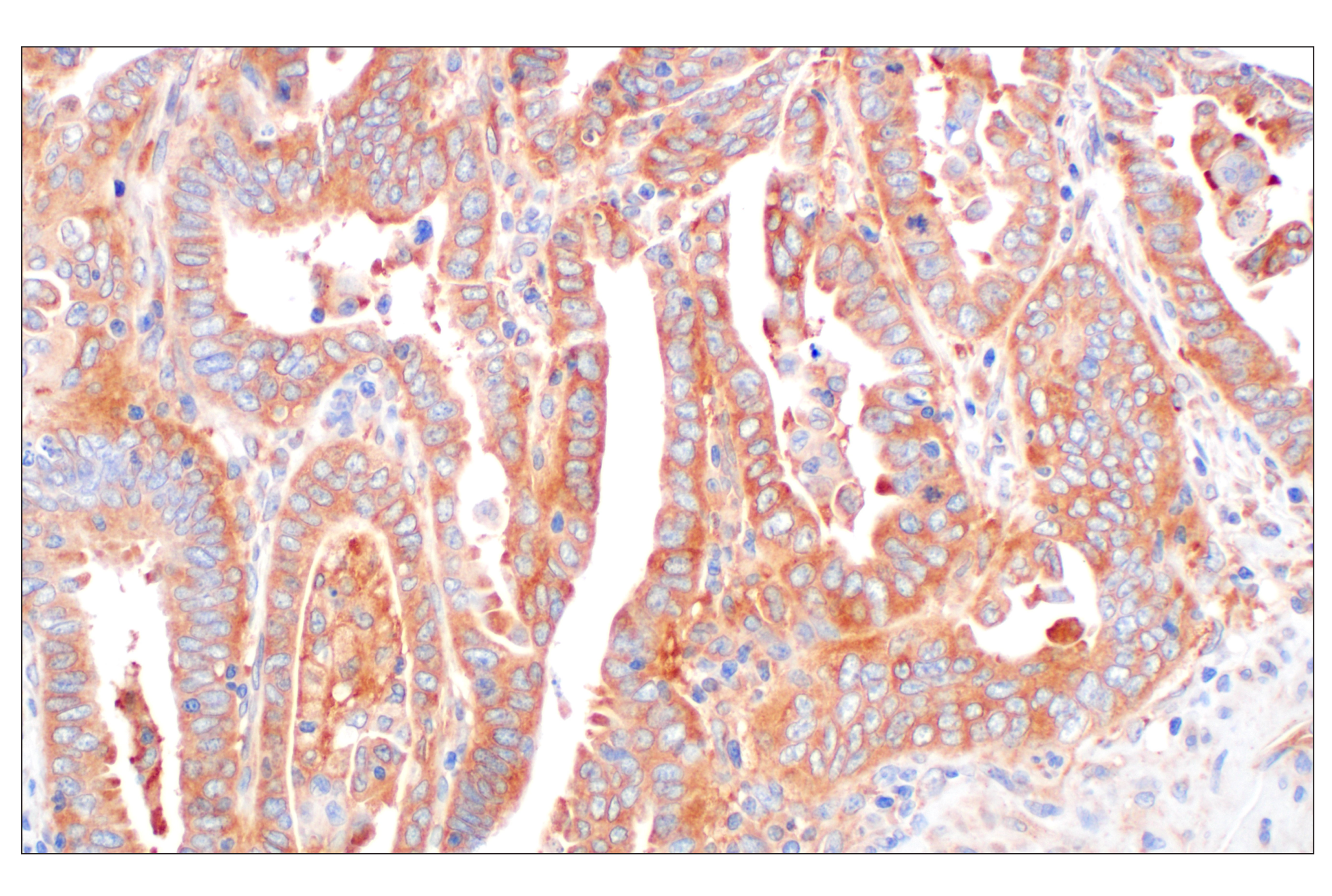 Immunohistochemistry Image 5: EEA1 (E9Q6G) Mouse mAb