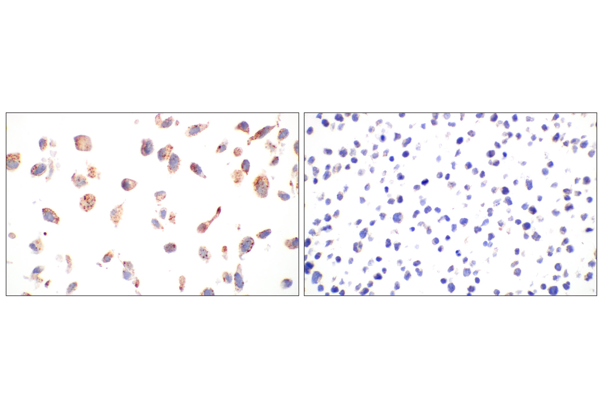 Immunohistochemistry Image 13: EEA1 (E9Q6G) Mouse mAb