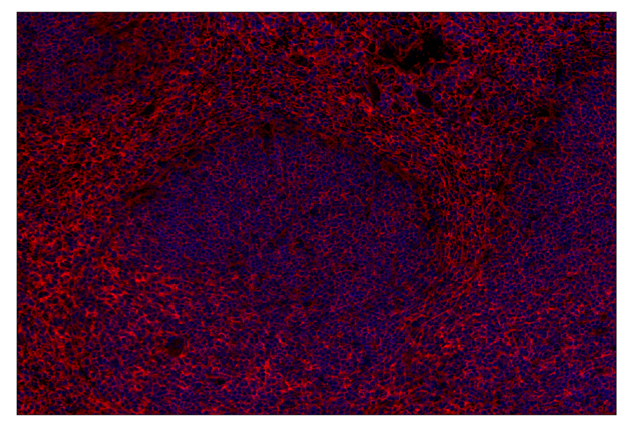 Immunohistochemistry Image 2: CD47 (E2V9V) Rabbit mAb (Alexa Fluor® 647 Conjugate)