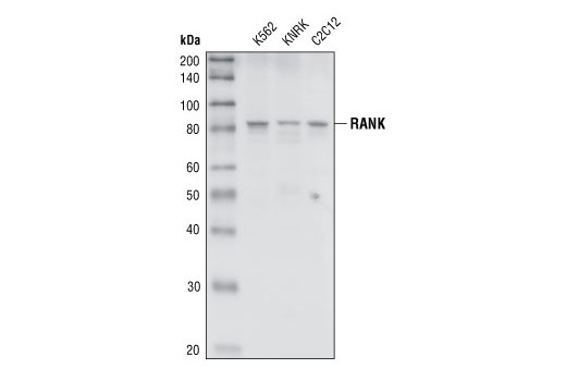 Western Blotting Image 1: RANK Antibody