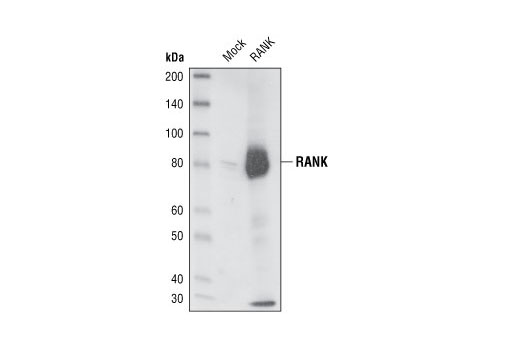 Western Blotting Image 2: RANK Antibody