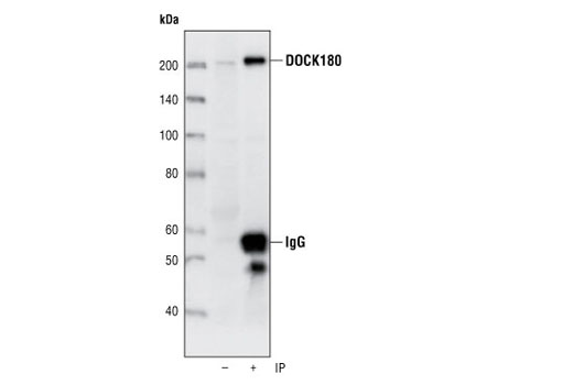 Immunoprecipitation Image 1: DOCK180 (C4C12) Rabbit mAb