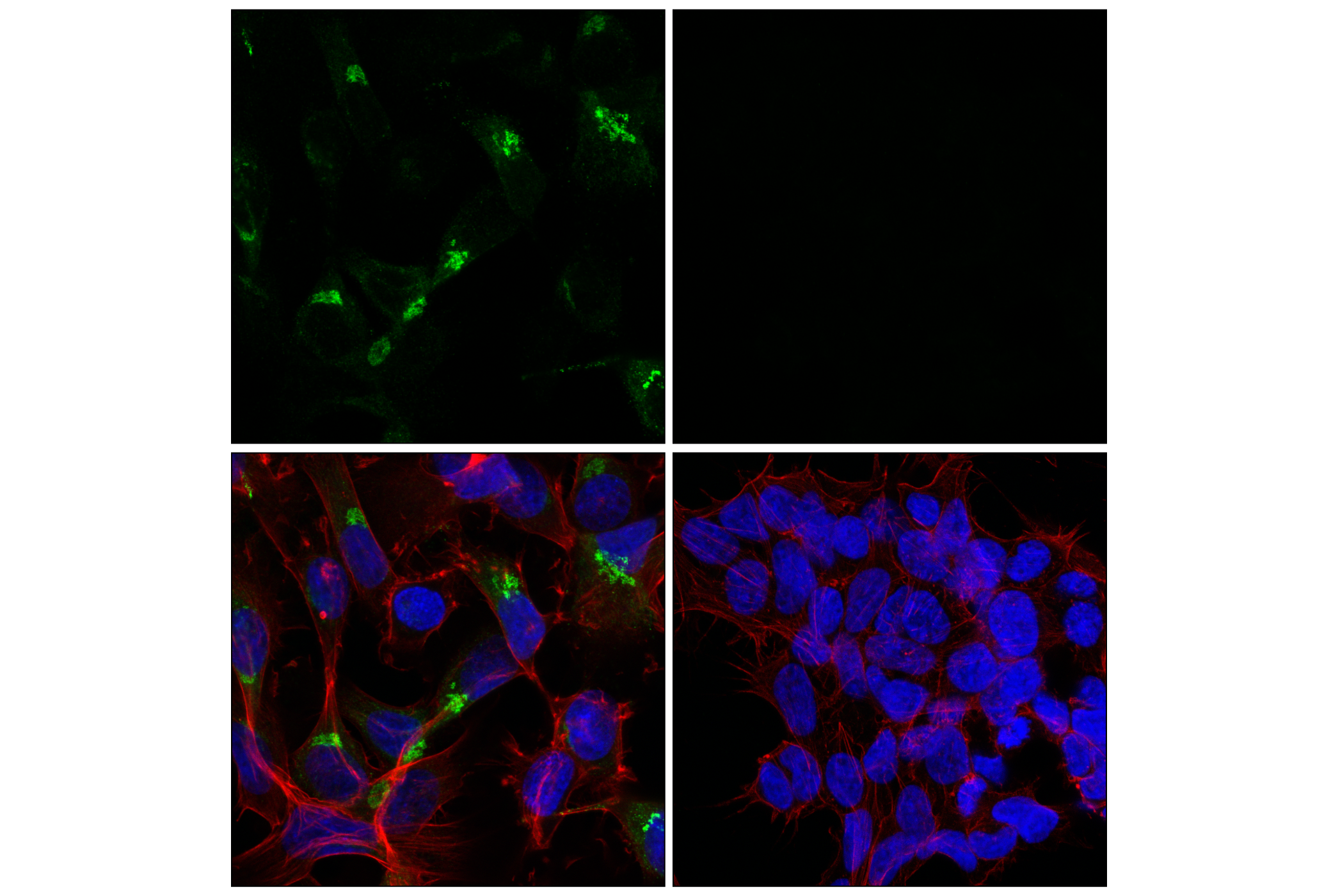 Immunofluorescence Image 1: GDF15/MIC1 (E4D3K) Rabbit mAb