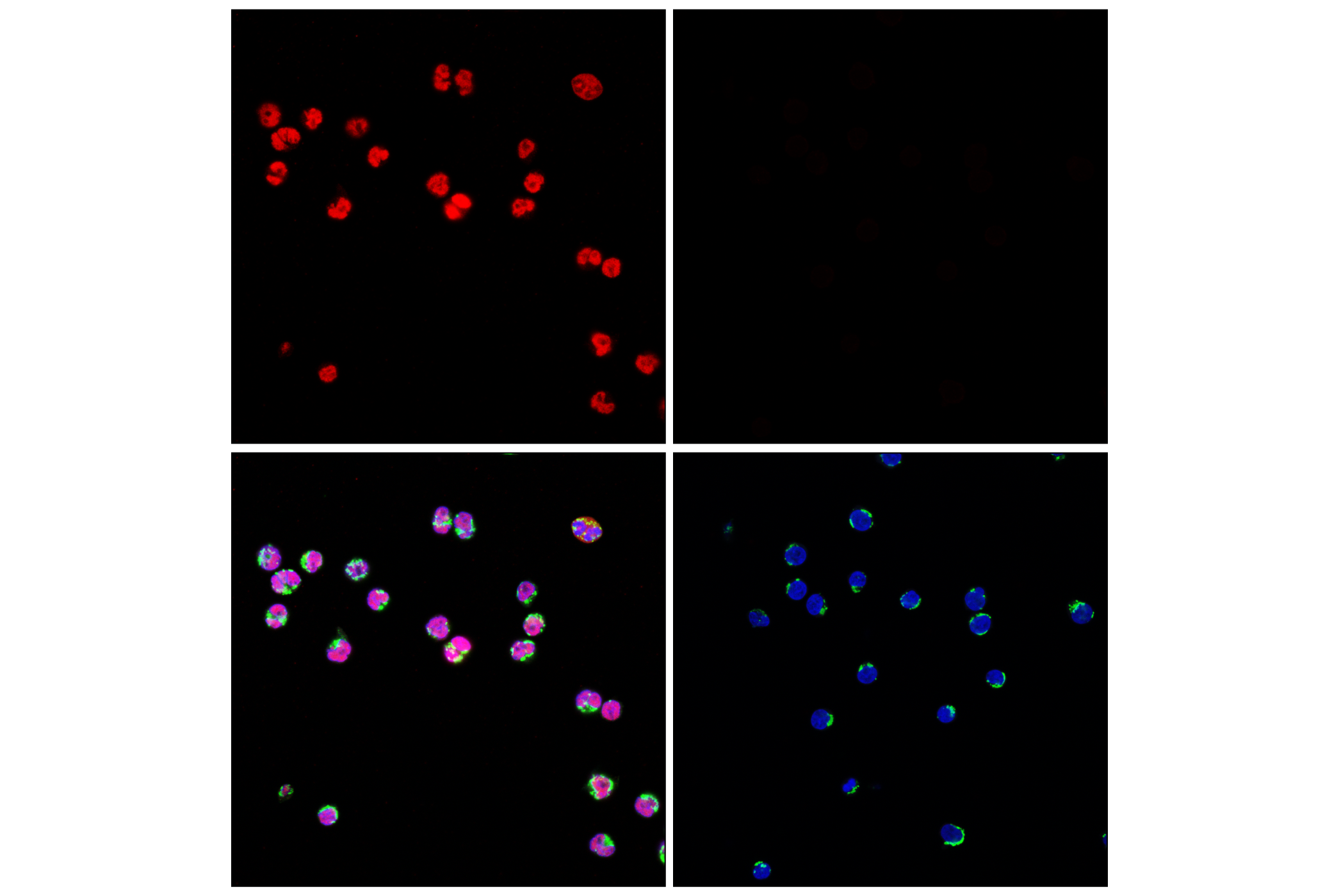 Immunofluorescence Image 1: PAX5 (D7H5X) XP® Rabbit mAb (Alexa Fluor® 647 Conjugate)