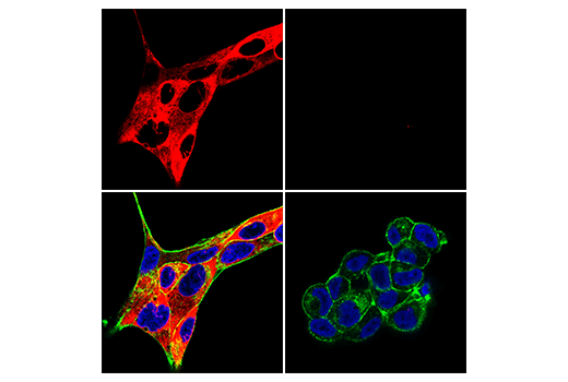 Immunofluorescence Image 1: Phospho-S6 Ribosomal Protein (Ser235/236) (D57.2.2E) XP® Rabbit mAb (Alexa Fluor® 647 Conjugate)