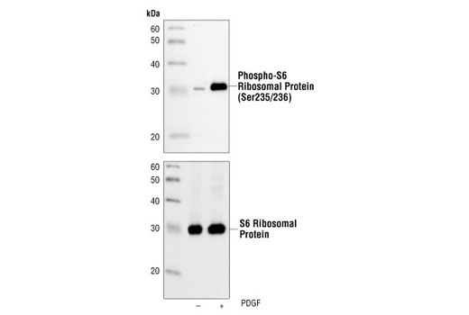 Western Blotting Image 1: Phospho-S6 Ribosomal Protein (Ser235/236) (2F9) Rabbit mAb