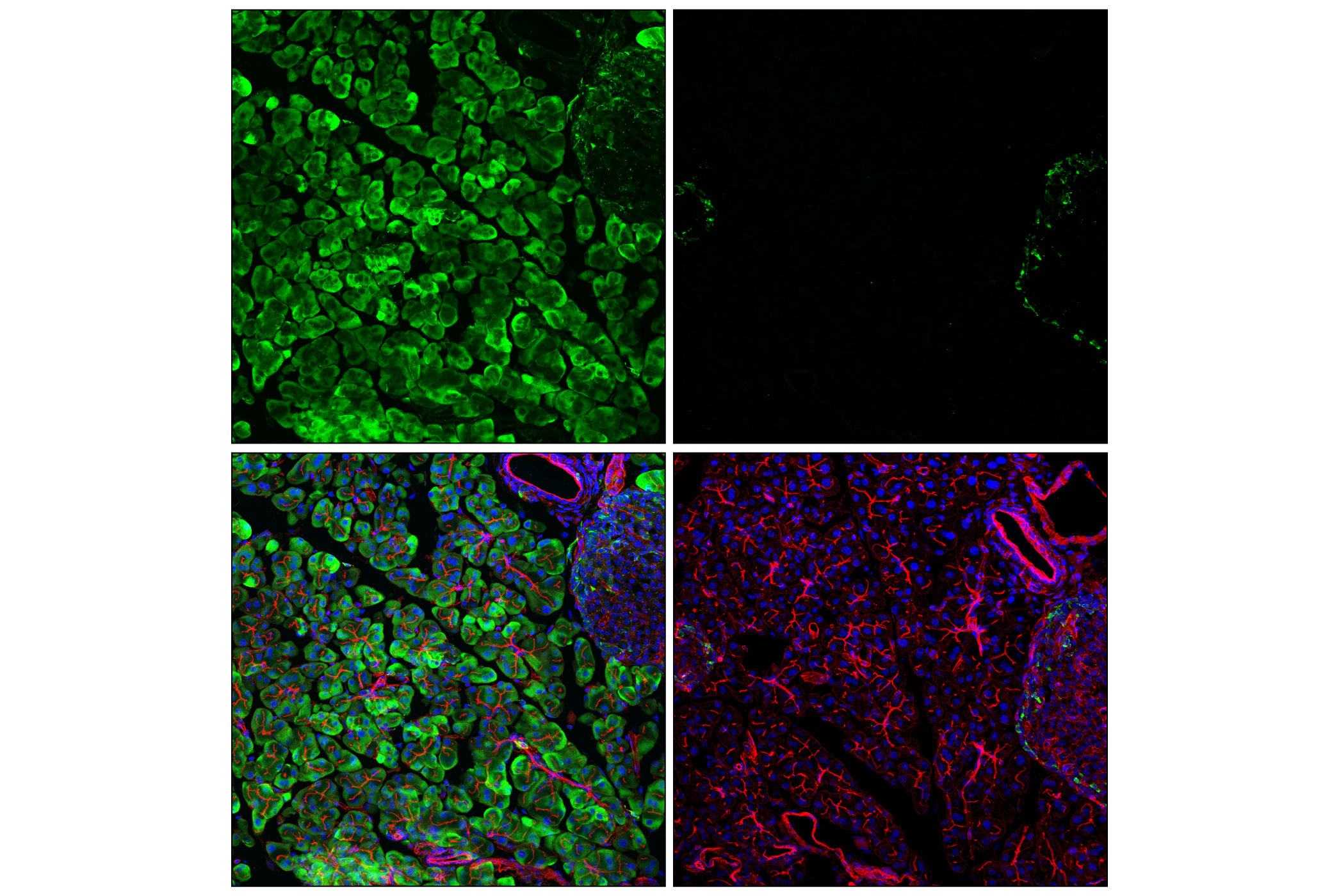Immunofluorescence Image 2: Phospho-S6 Ribosomal Protein (Ser235/236) (D57.2.2E) XP® Rabbit mAb