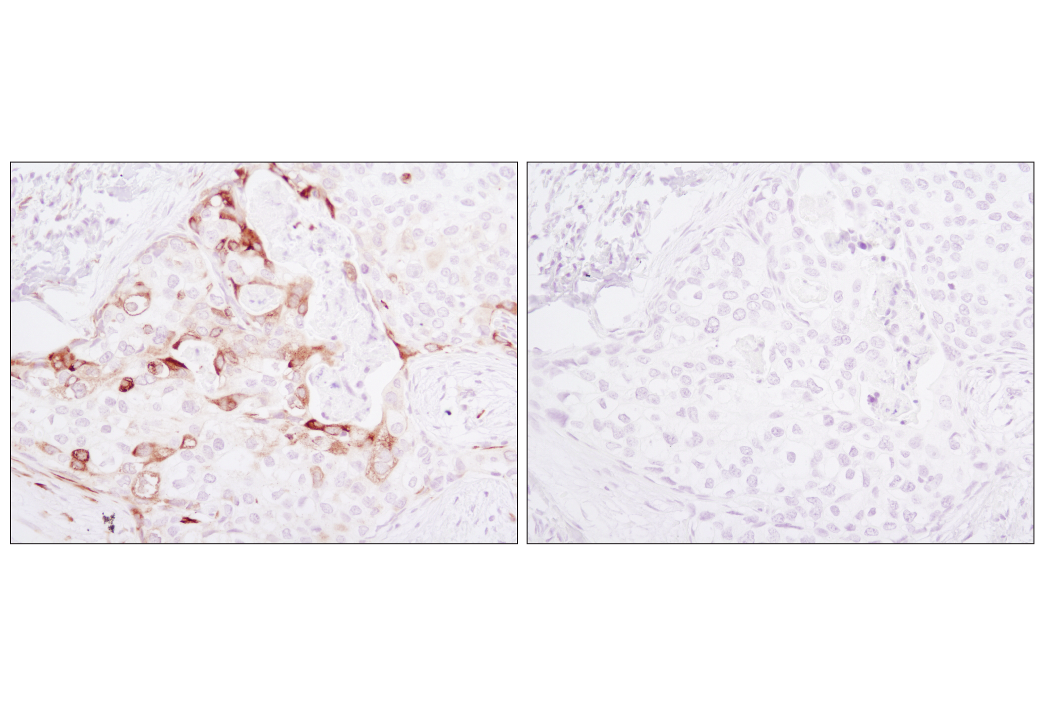  Image 17: PhosphoPlus® S6 Ribosomal Protein (Ser235/Ser236) Antibody Duet