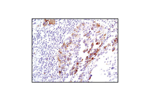 Immunohistochemistry Image 5: Phospho-S6 Ribosomal Protein (Ser235/236) (D57.2.2E) XP® Rabbit mAb