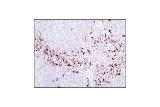 Immunohistochemistry Image 6: Phospho-S6 Ribosomal Protein (Ser235/236) (D57.2.2E) XP® Rabbit mAb