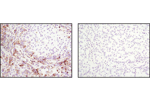  Image 18: PhosphoPlus® S6 Ribosomal Protein (Ser235/Ser236) Antibody Duet
