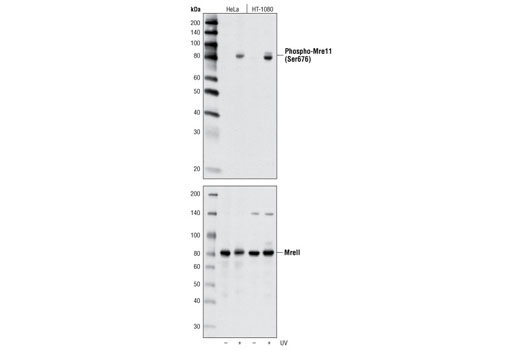  Image 5: MRN Complex Antibody Sampler Kit