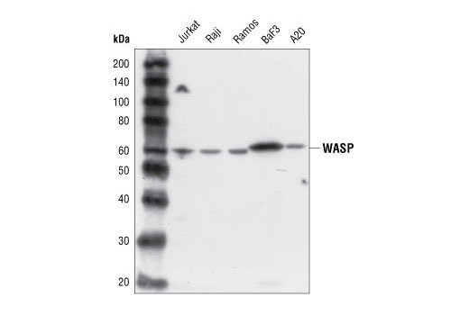 Western Blotting Image 1: WASP Antibody