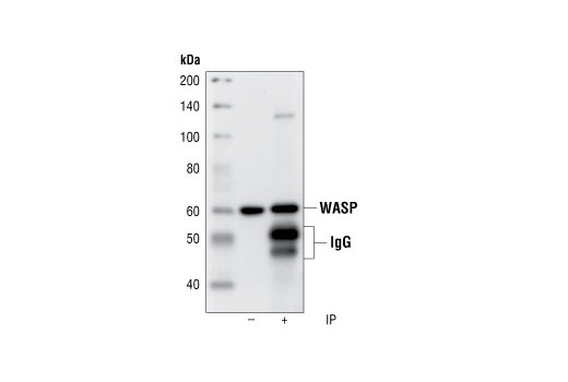 Immunoprecipitation Image 1: WASP Antibody