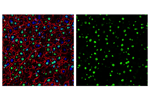 Immunofluorescence Image 2: FUS/TLS (E3O8I) Rabbit mAb (BSA and Azide Free)