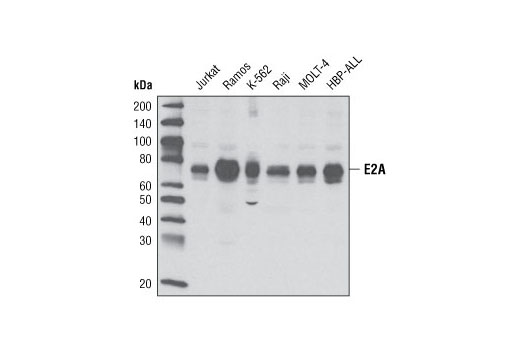 Western Blotting Image 1: E2A Antibody