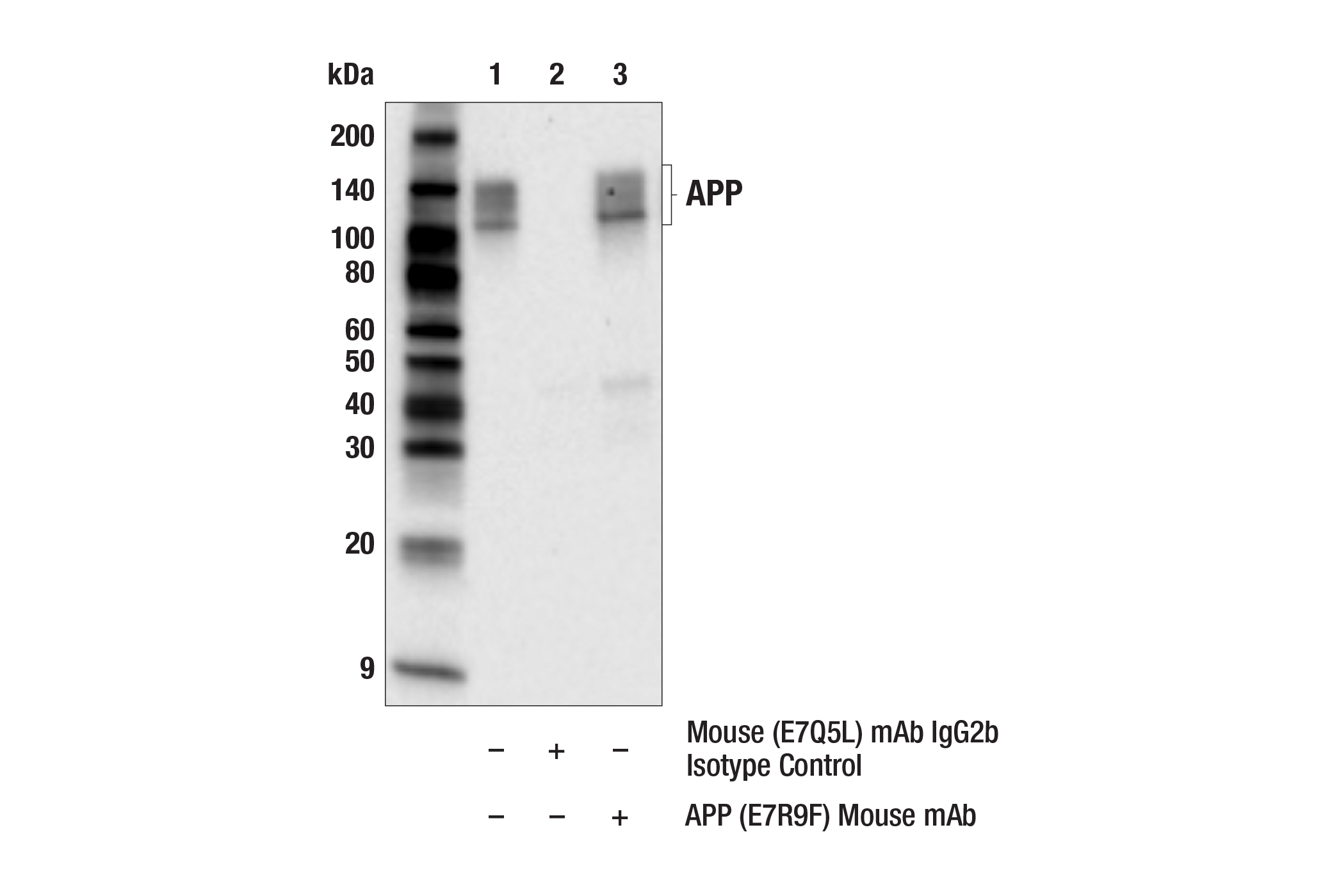 Immunoprecipitation Image 1: APP (E7R9F) Mouse mAb