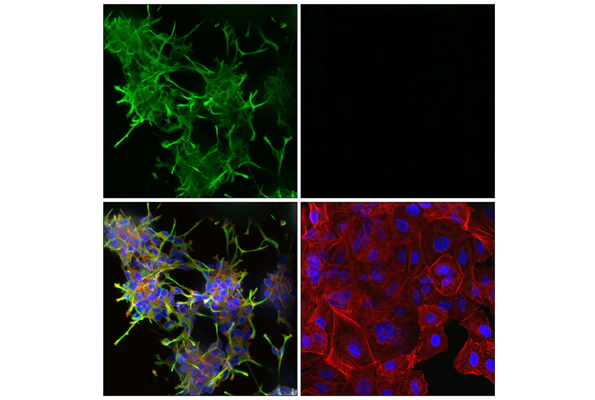 Immunofluorescence Image 3: Doublecortin (F6K9E) Rabbit mAb (BSA and Azide Free)