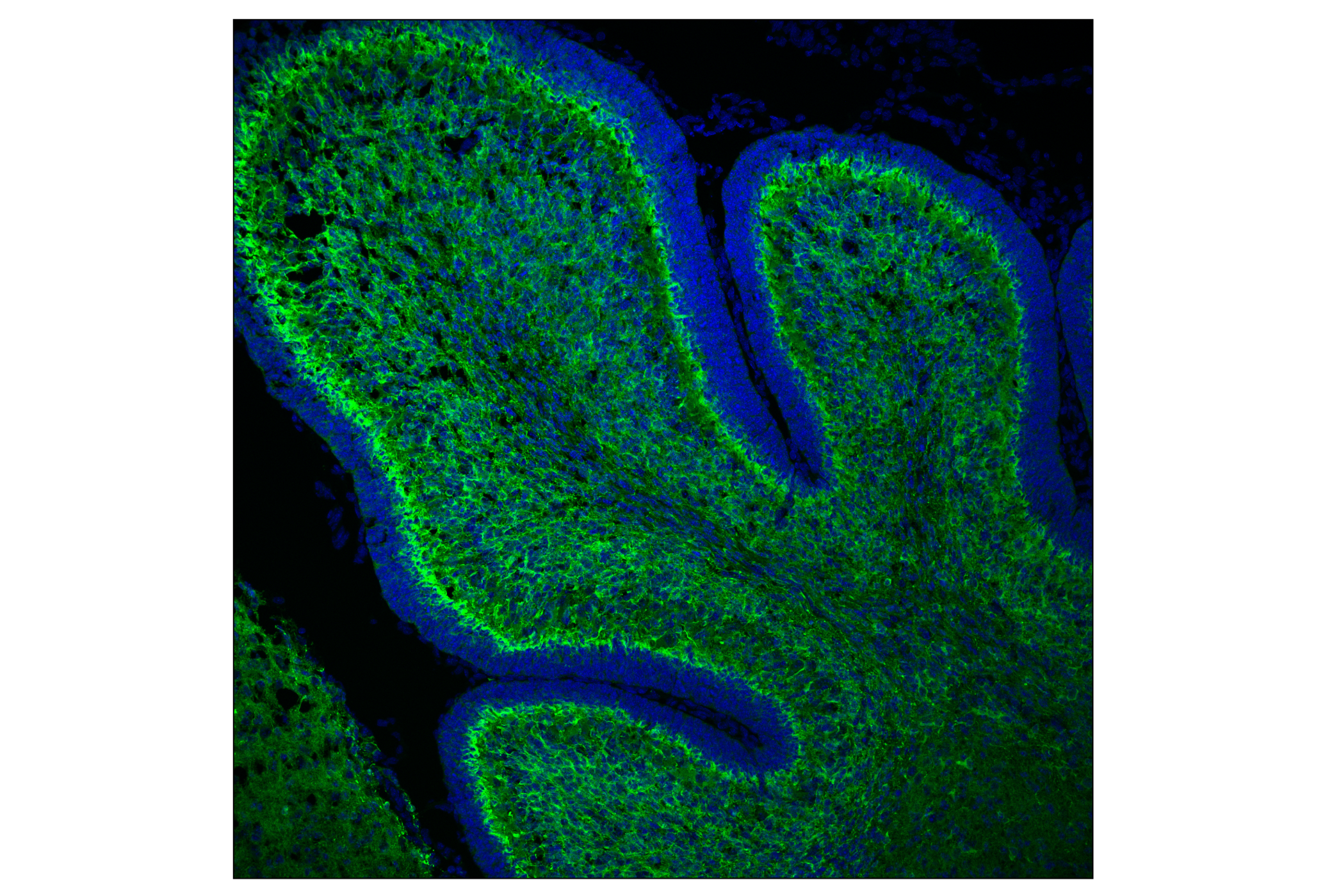 Immunofluorescence Image 1: Doublecortin (F6K9E) Rabbit mAb (BSA and Azide Free)