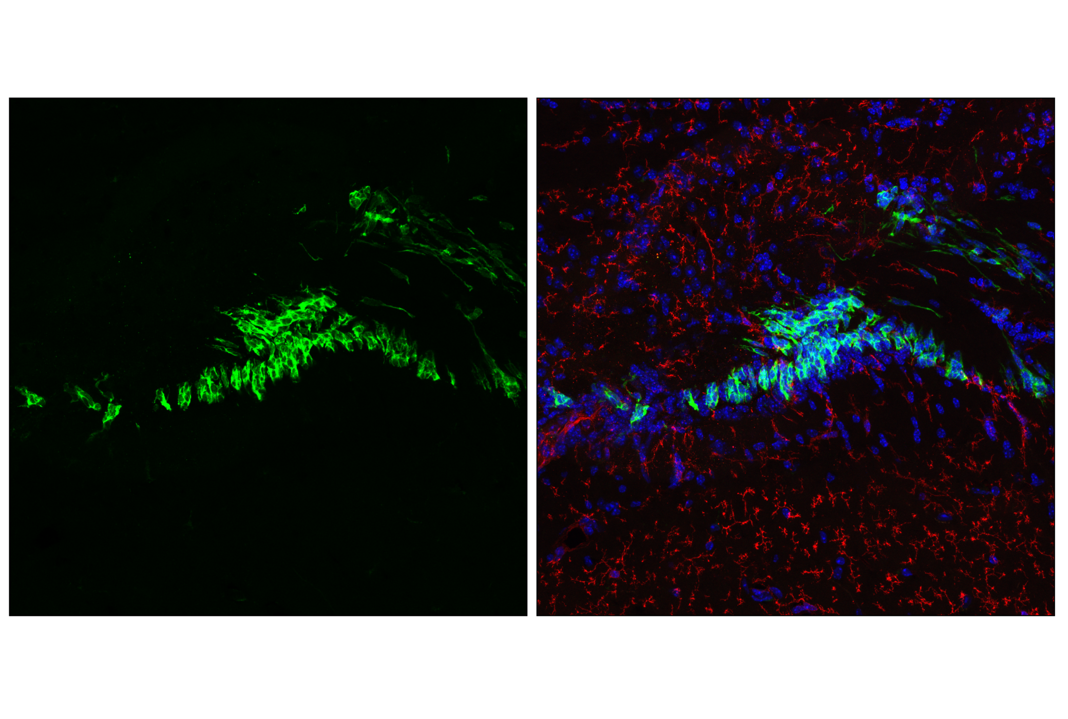 Immunofluorescence Image 2: Doublecortin (F6K9E) Rabbit mAb (BSA and Azide Free)