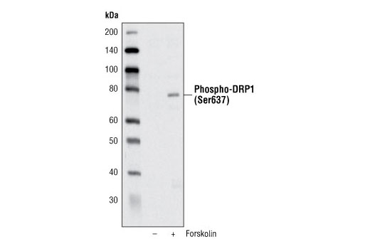 Western Blotting Image 1: Phospho-DRP1 (Ser637) Antibody