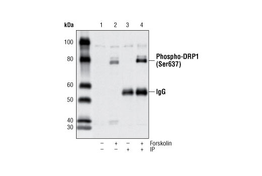 Immunoprecipitation Image 1: Phospho-DRP1 (Ser637) Antibody