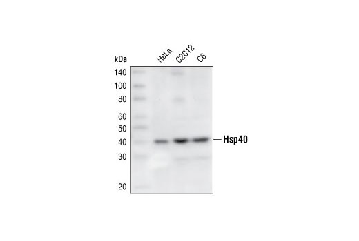 Western Blotting Image 1: HSP40 Antibody