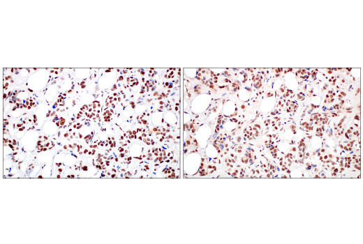 Immunohistochemistry Image 12: METTL14 (E2G9A) Rabbit mAb