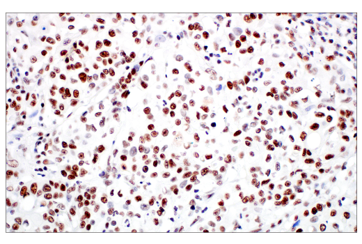 Immunohistochemistry Image 3: METTL14 (E2G9A) Rabbit mAb