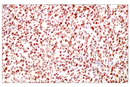 Immunohistochemistry Image 8: METTL14 (E2G9A) Rabbit mAb