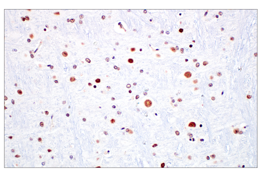 Immunohistochemistry Image 11: METTL14 (E2G9A) Rabbit mAb