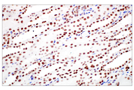 Immunohistochemistry Image 5: METTL14 (E2G9A) Rabbit mAb
