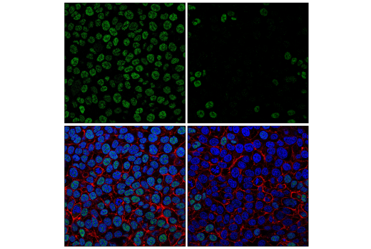 Immunofluorescence Image 1: METTL14 (E2G9A) Rabbit mAb