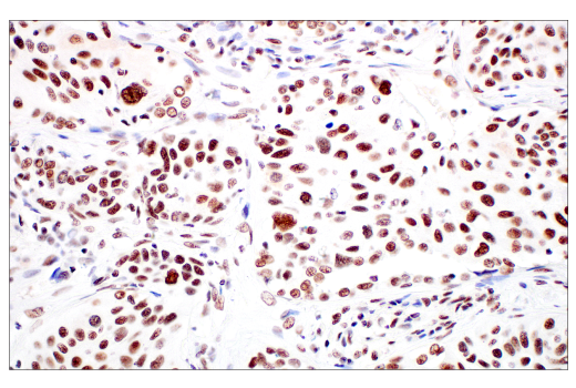 Immunohistochemistry Image 1: METTL14 (E2G9A) Rabbit mAb