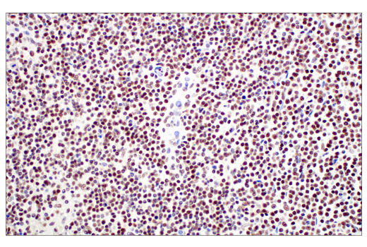 Immunohistochemistry Image 2: METTL14 (E2G9A) Rabbit mAb