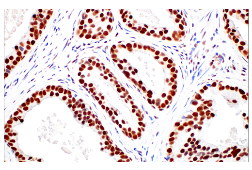 Immunohistochemistry Image 4: METTL14 (E2G9A) Rabbit mAb