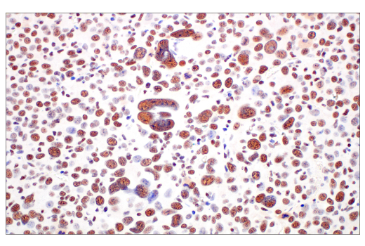 Immunohistochemistry Image 7: METTL14 (E2G9A) Rabbit mAb