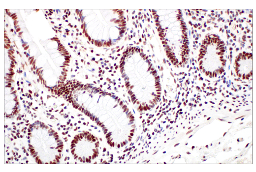 Immunohistochemistry Image 6: METTL14 (E2G9A) Rabbit mAb