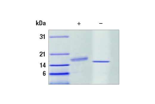  Image 1: Human G-CSF Recombinant Protein