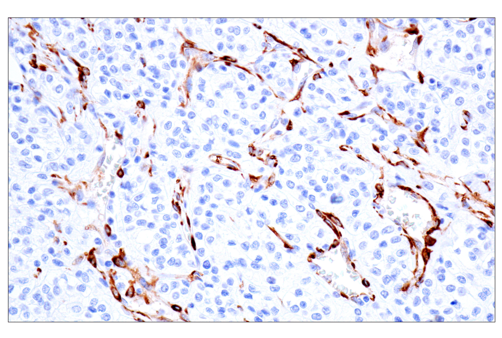 Immunohistochemistry Image 3: MAP1B (E8S8R) Rabbit mAb (BSA and Azide Free)