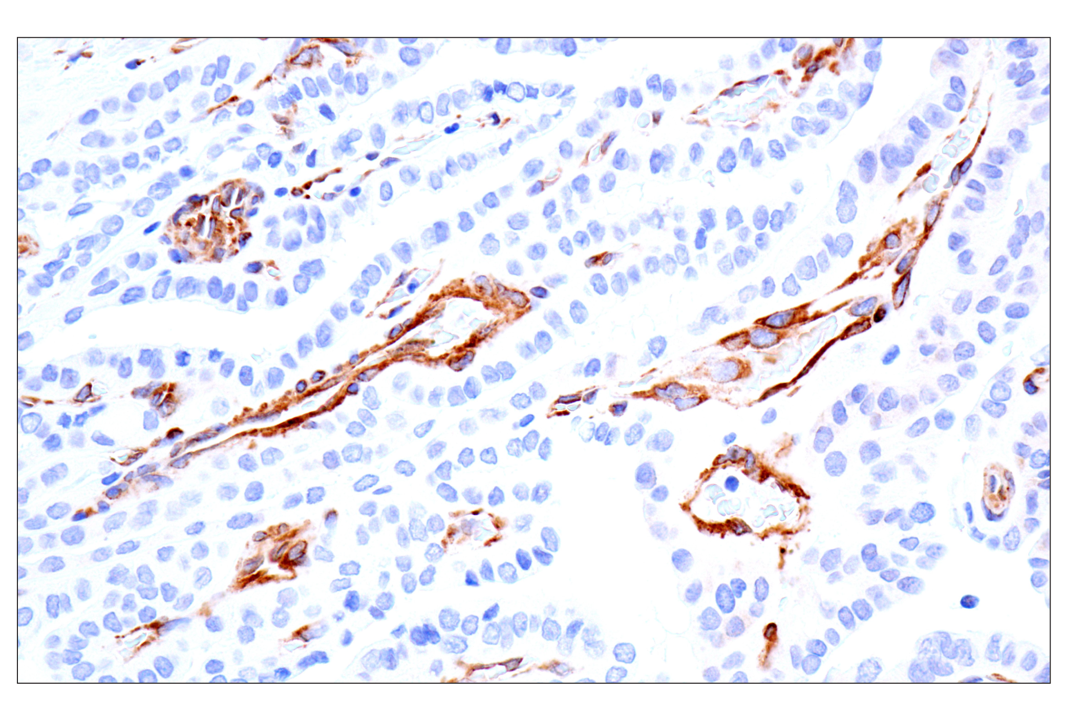 Immunohistochemistry Image 5: MAP1B (E8S8R) Rabbit mAb (BSA and Azide Free)