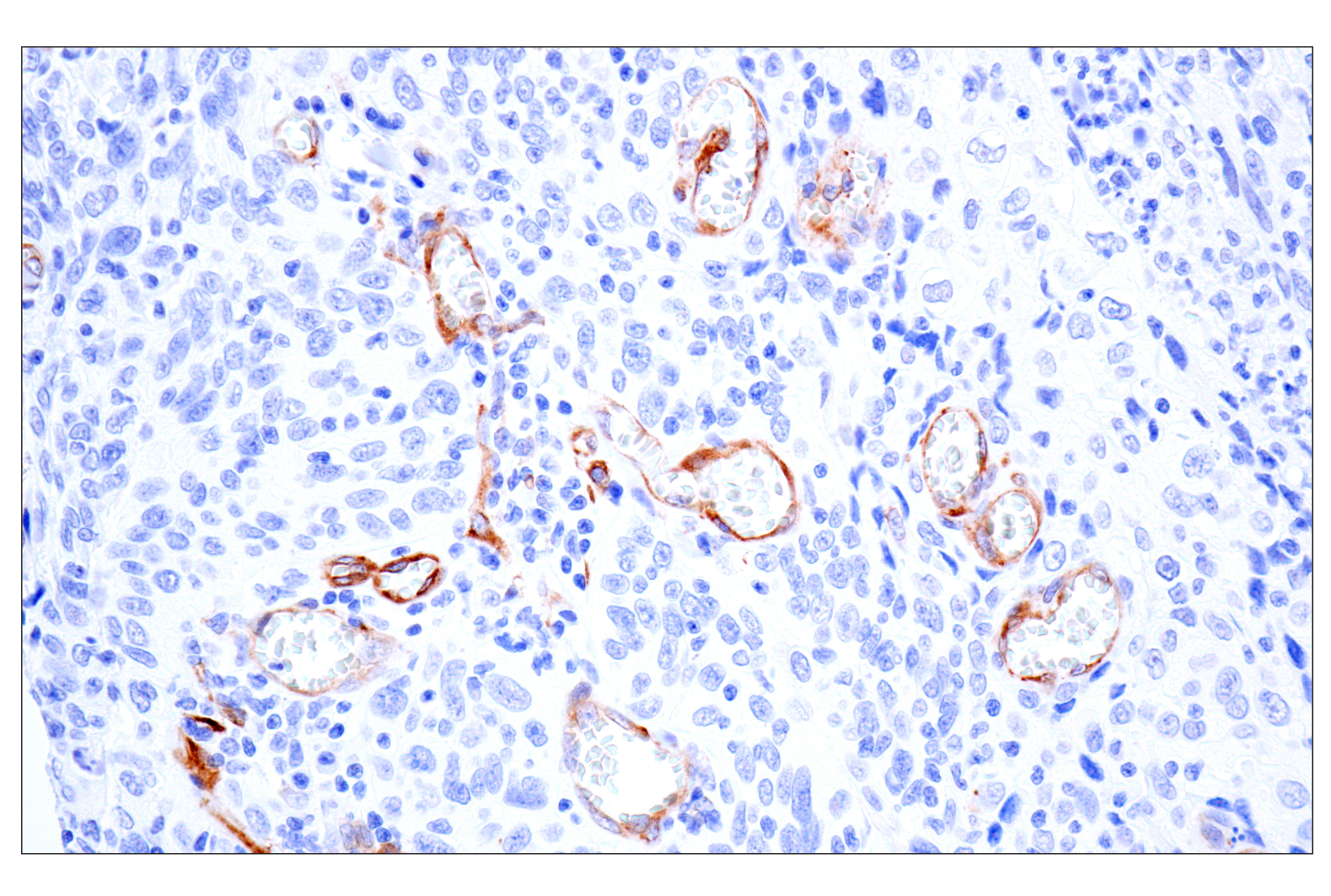 Immunohistochemistry Image 6: MAP1B (E8S8R) Rabbit mAb (BSA and Azide Free)