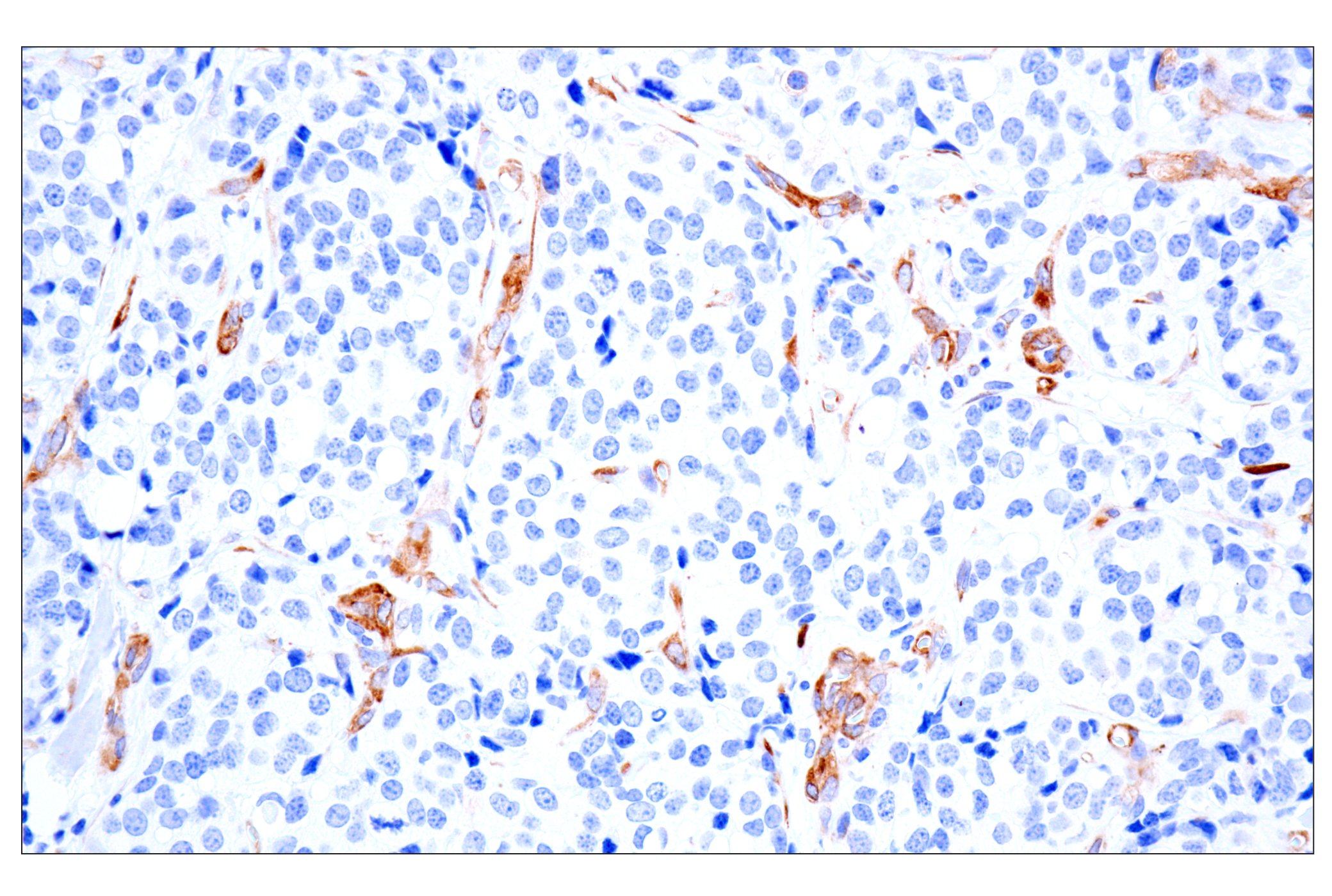 Immunohistochemistry Image 7: MAP1B (E8S8R) Rabbit mAb (BSA and Azide Free)