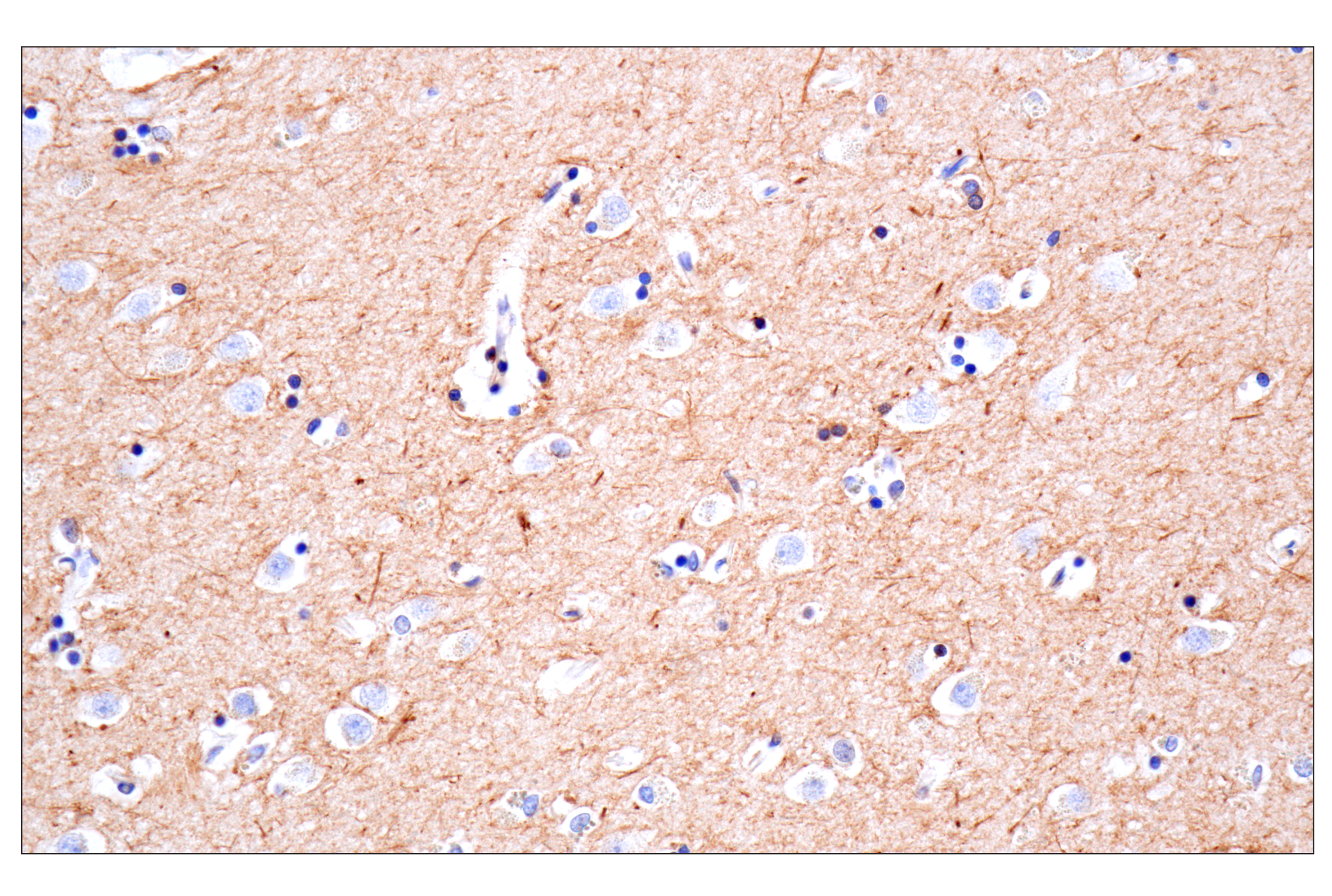 Immunohistochemistry Image 9: MAP1B (E8S8R) Rabbit mAb (BSA and Azide Free)