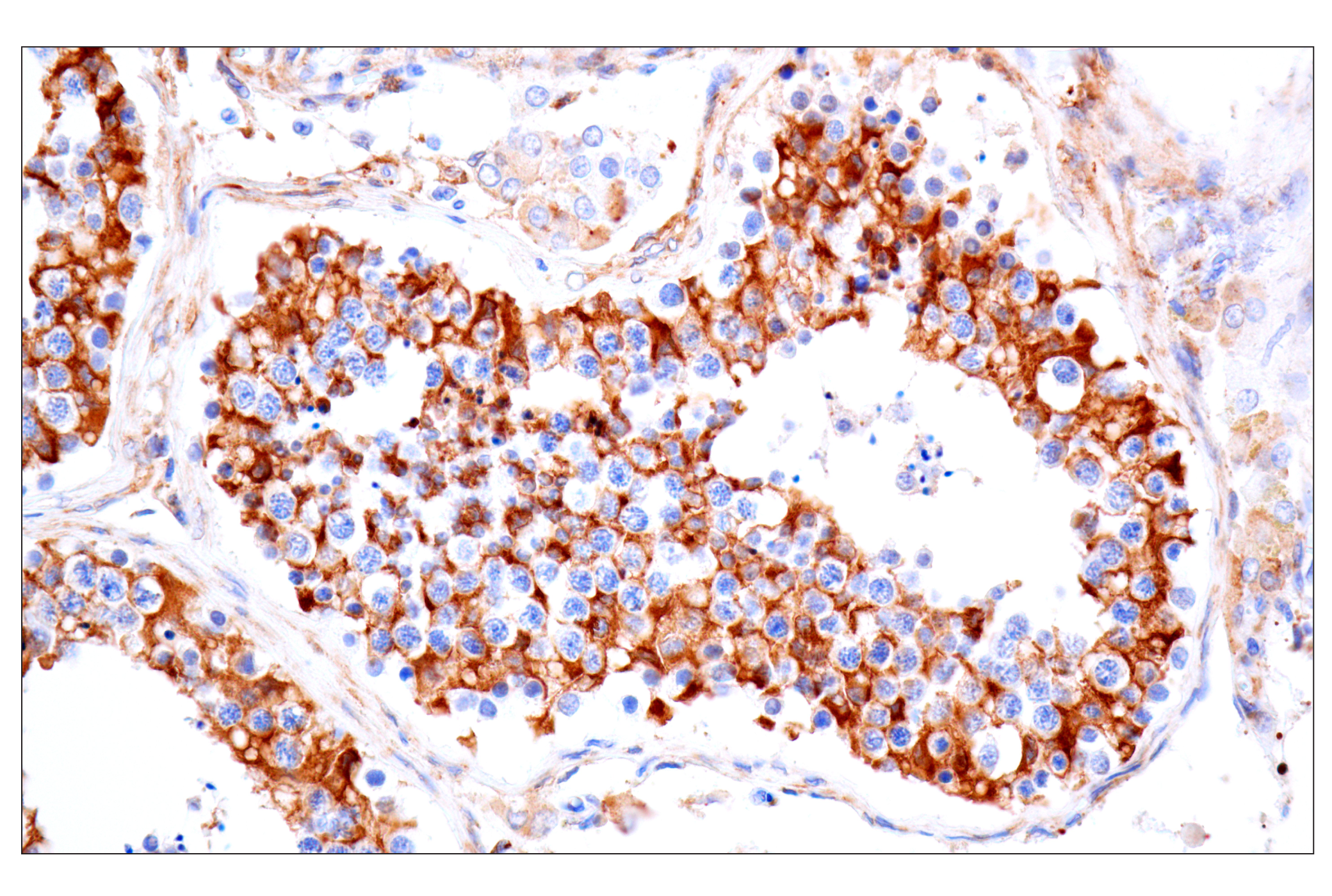 Immunohistochemistry Image 14: MAP1B (E8S8R) Rabbit mAb (BSA and Azide Free)
