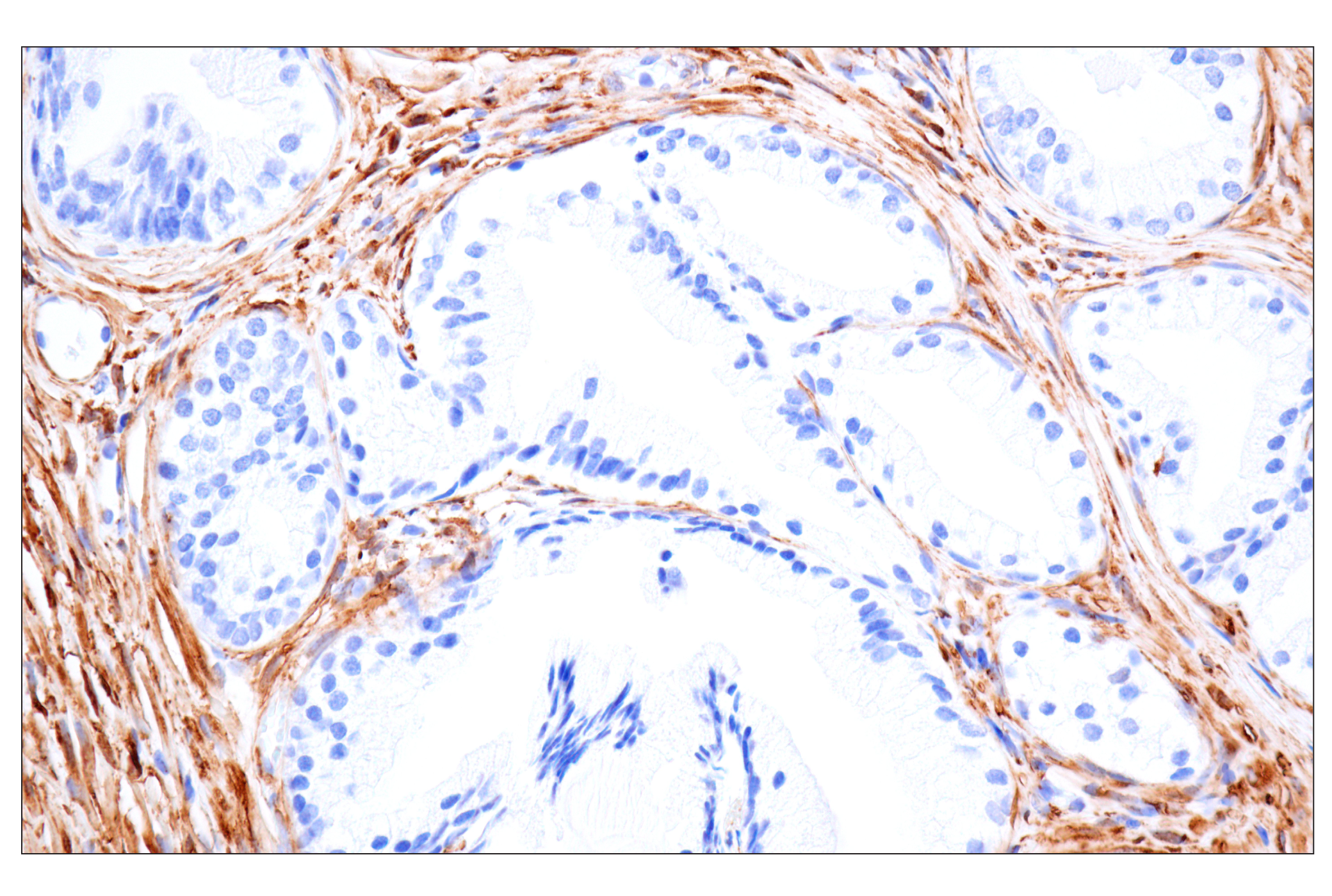 Immunohistochemistry Image 16: MAP1B (E8S8R) Rabbit mAb (BSA and Azide Free)