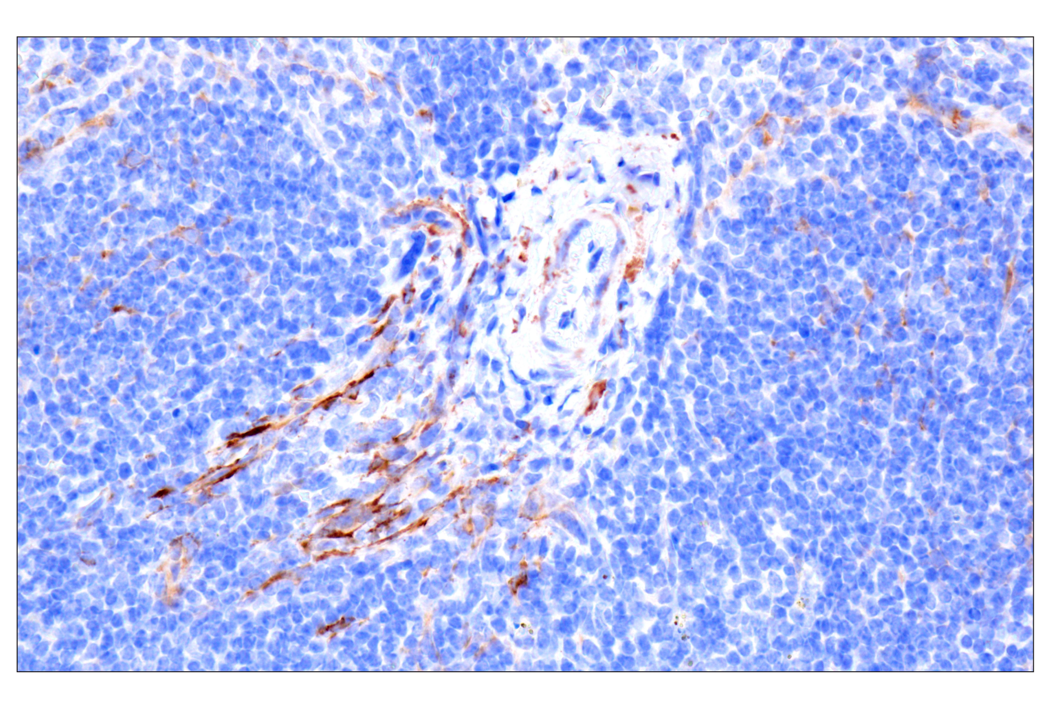Immunohistochemistry Image 19: MAP1B (E8S8R) Rabbit mAb (BSA and Azide Free)