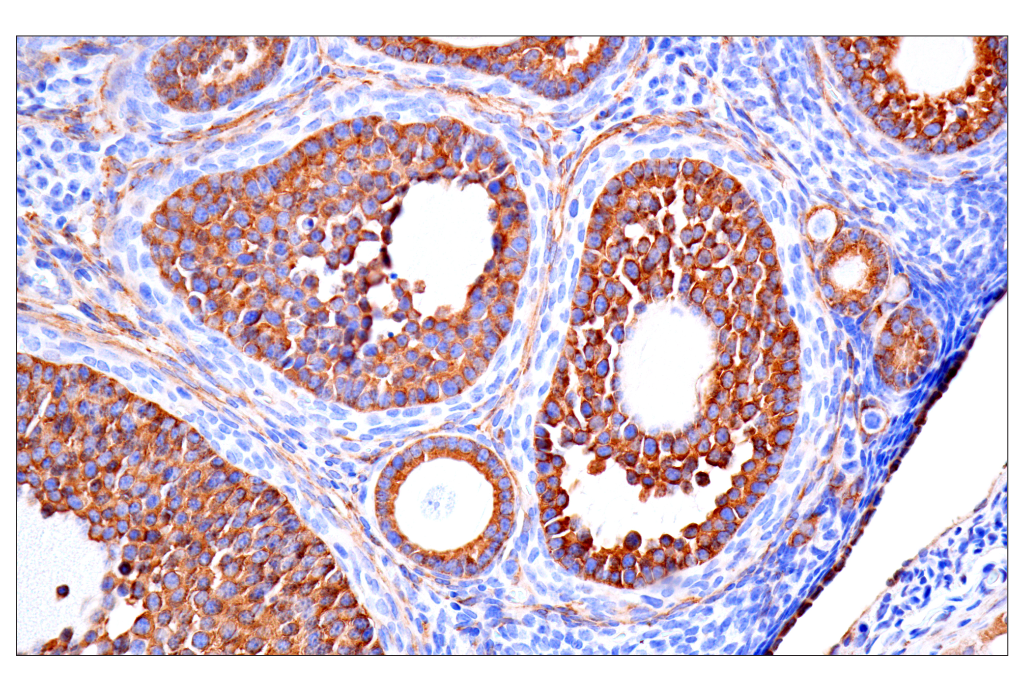 Immunohistochemistry Image 20: MAP1B (E8S8R) Rabbit mAb (BSA and Azide Free)